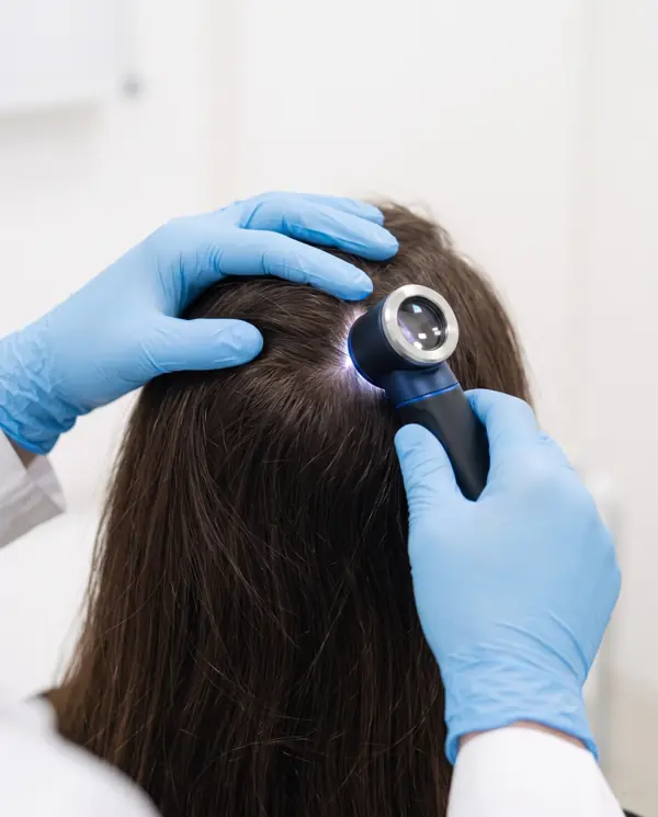 Exame do couro cabeludo com dermatoscópio